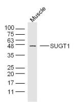 SUGT1 antibody