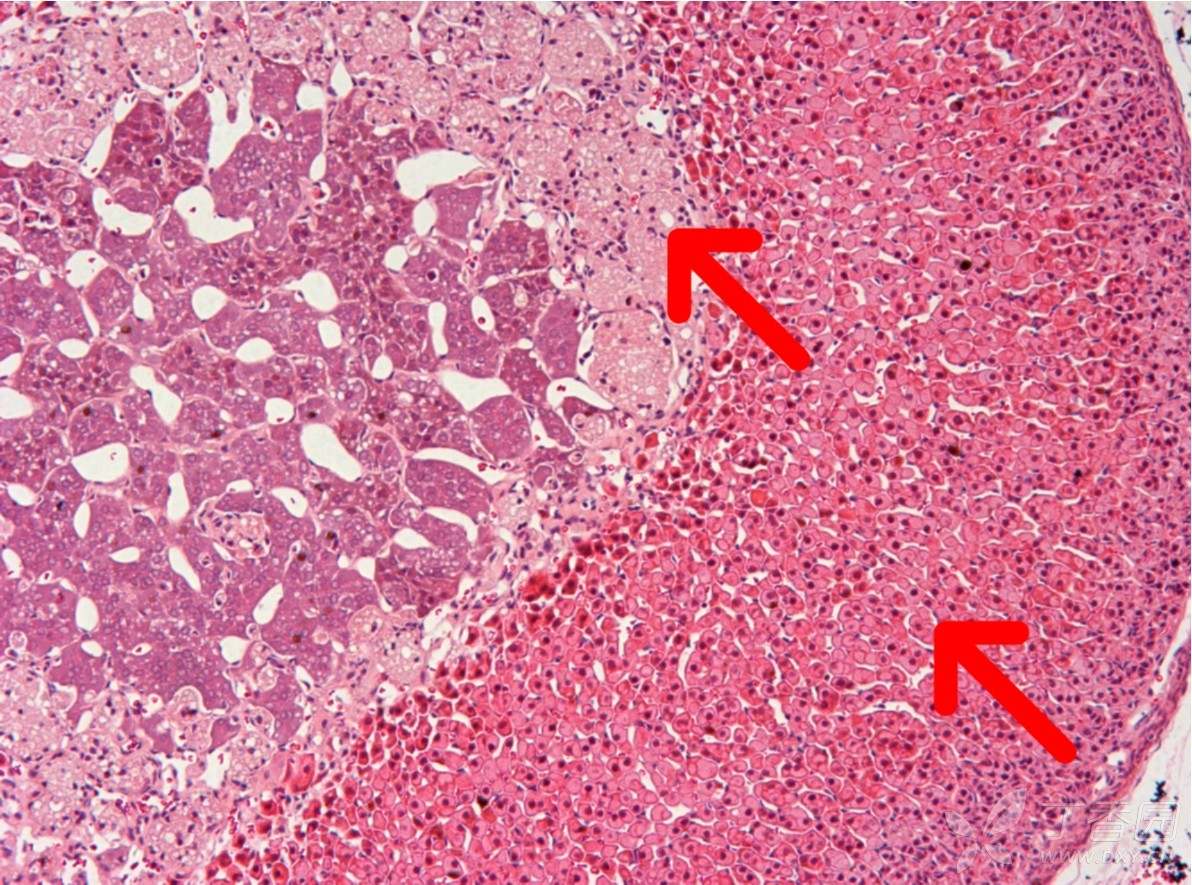 想请教大神肾上腺网状带以及束状带he染况