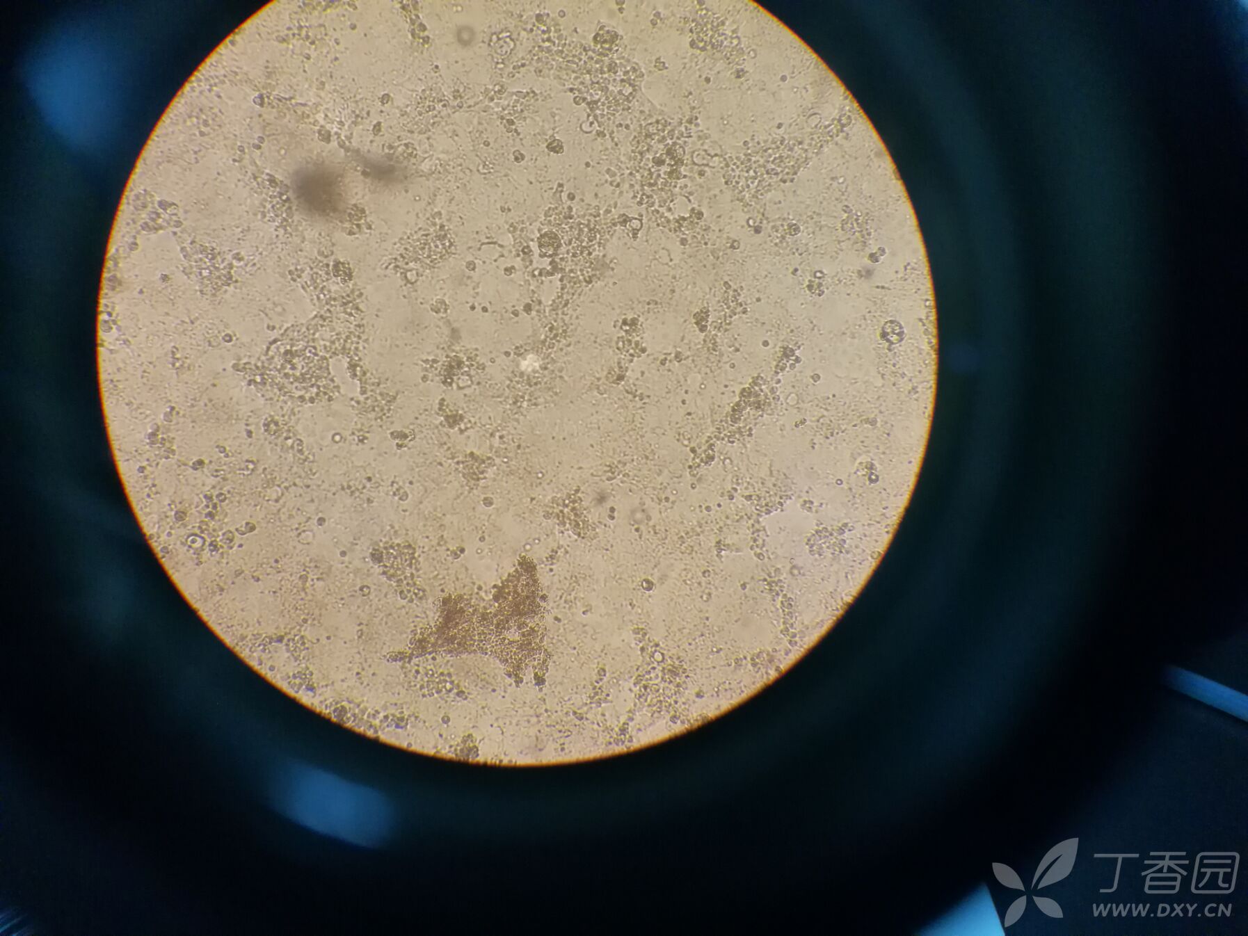 caco2细胞培养出问题,成片脱落,边缘翘起,求大神指点!