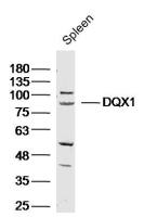 DQX1 antibody