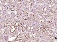 LRCH1 antibody