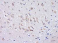FBXO33 antibody