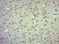 TRPM4 antibody