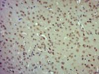 Etv5 antibody