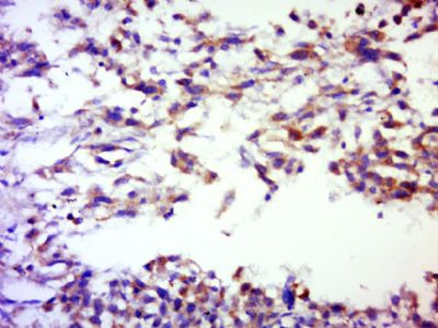 SERPINB12 antibody