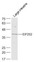 EIF2S2 antibody