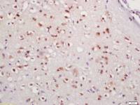 IFI-202 antibody