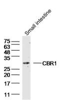 CBR1 antibody