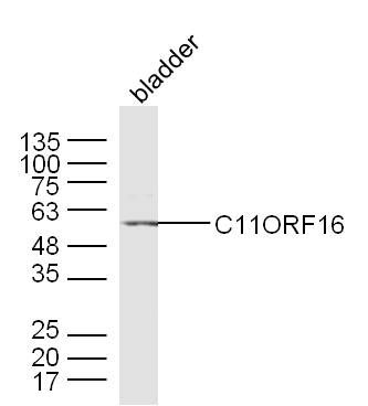 C11ORF16 antibody