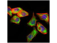 磷酸化上皮细胞癌转化蛋白2抗体
