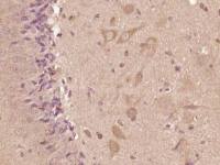 CSEN antibody