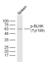 Phospho-BLNK(Tyr189) antibody
