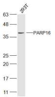 PARP16 antibody