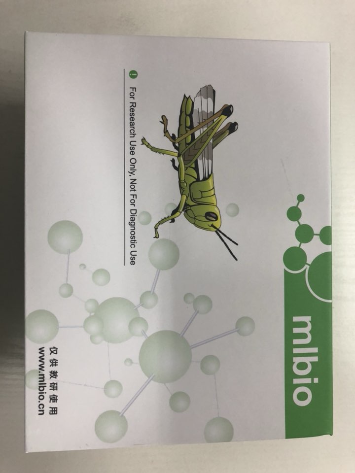 小鼠禽流感病毒抗原(AIV)ELISA试剂盒