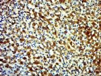 ECRG4 antibody