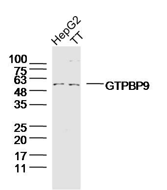 GTPBP9 antibody