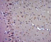 RNF61/MKRN1 antibody