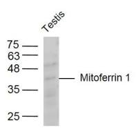 Mitoferrin 1 antibody