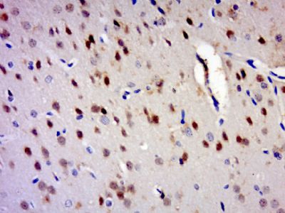 ZNF828 antibody