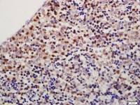 TXNDC9 antibody
