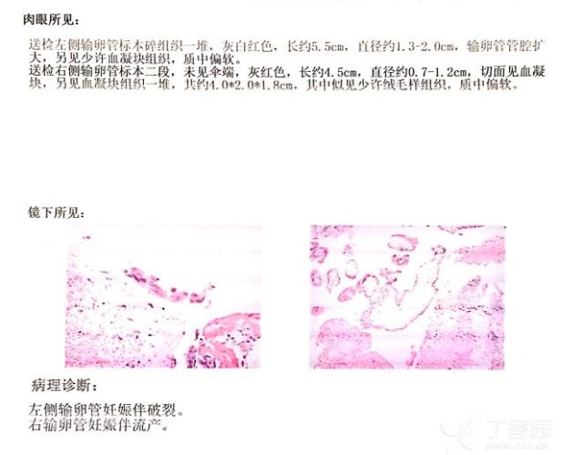 屏幕快照 2018-07-11 上午11.26.56.png