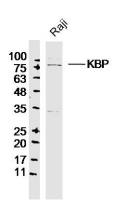 KBP antibody