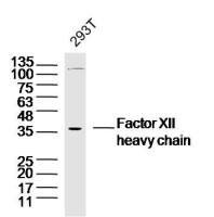 Factor XIIa heavy chain antibody