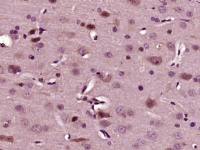 phospho-Stathmin 1 (Ser63) antibody