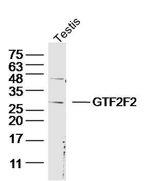 GTF2F2通用转录因子IIF亚基2/TFIIF RAP 30抗体