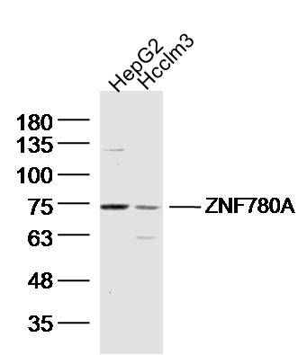 ZNF780A锌指蛋白780A抗体