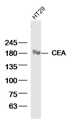 CEA antibody