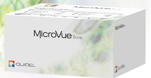 MicroVue YKL-40 ELISA人软骨糖蛋白39 ELISA试剂盒
