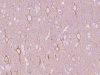 beta I Tubulin antibody