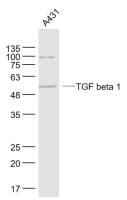 TGF beta 1 antibody