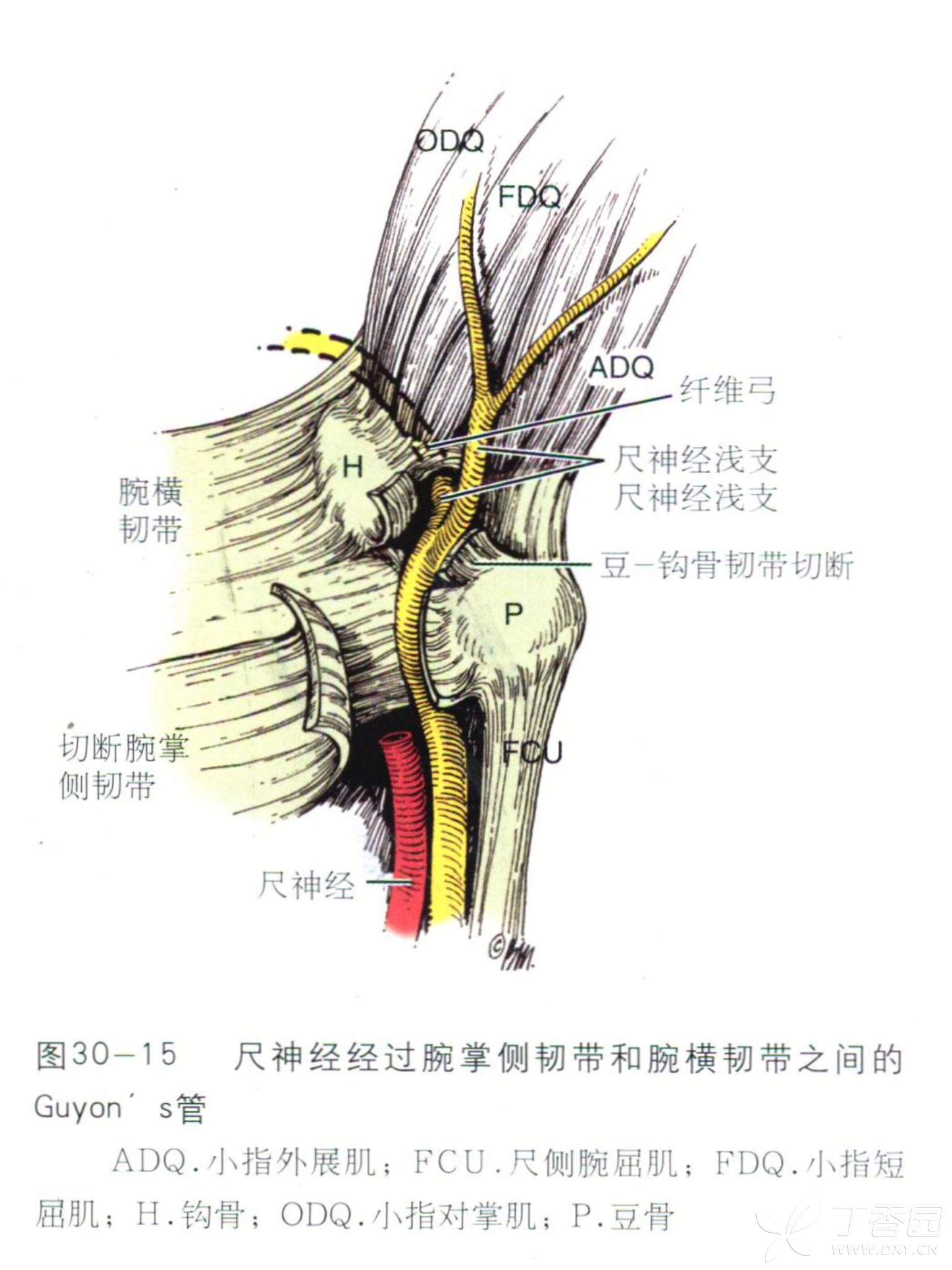 尺管综合征手术图解图片