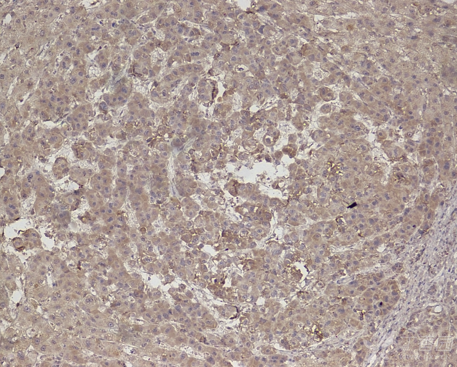 有没有可能是1.dab的质量问题,里面的过氧化氢换成自己配?2.