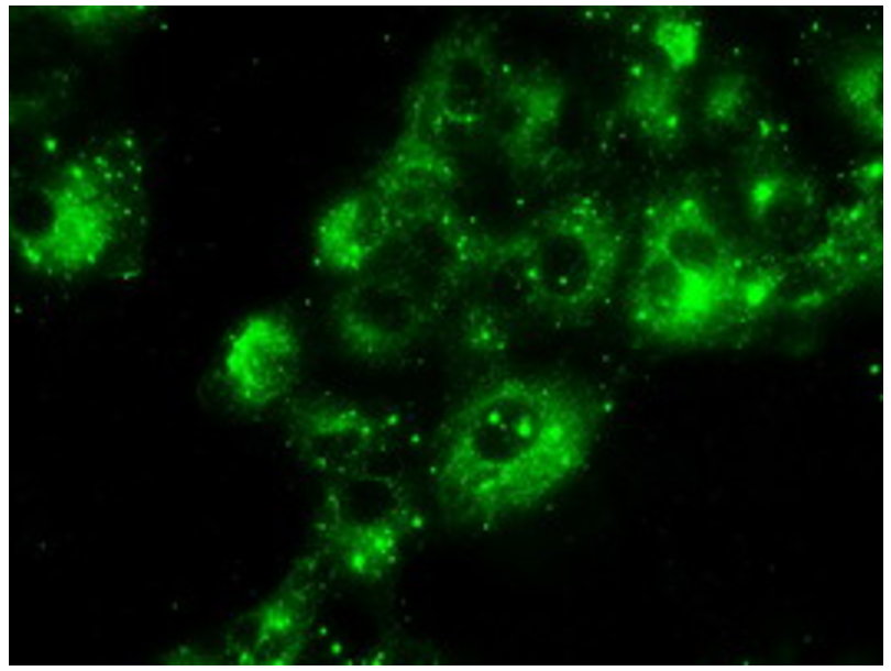 白细胞介素-2单克隆抗体