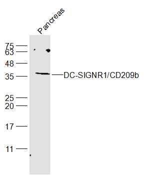 DC-SIGNR1/CD209b抗体