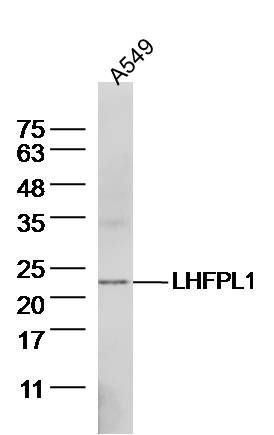 LHFPL1脂肪瘤高迁移率融合蛋白样蛋白1抗体
