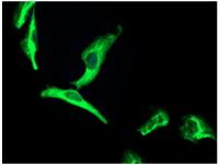 层粘连蛋白B2γ1抗体