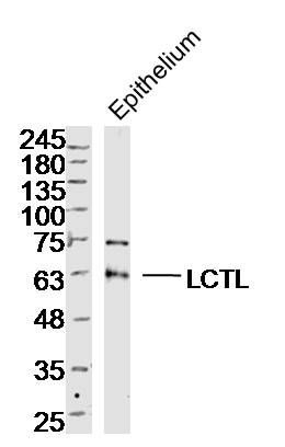 LCTL乳糖酶样蛋白抗体