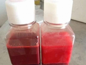 我们在保存血清时应该注意哪些问题呢？