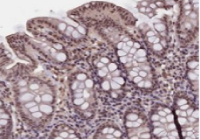 G蛋白偶联胆汁酸受体1