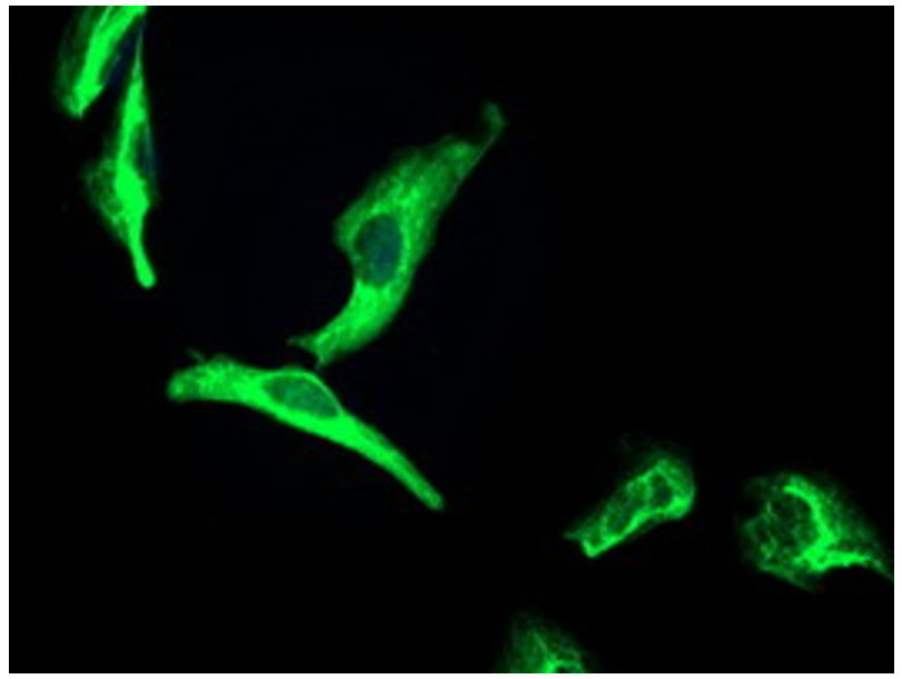淋巴细胞特异性蛋白酪氨酸激酶抗体