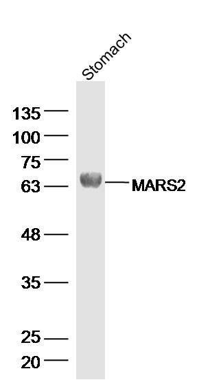 MARS2甲硫氨酸转运RNA合成酶2抗体
