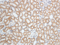 稳转细胞系构建