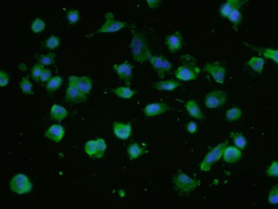 NUP214核孔复合蛋白Nup214抗体