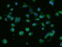 NUP214核孔复合蛋白Nup214抗体