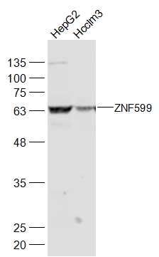 ZNF599锌指蛋白599抗体