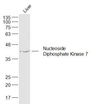 Nucleoside Diphosphate Kinase 7二磷酸核苷激酶7抗体